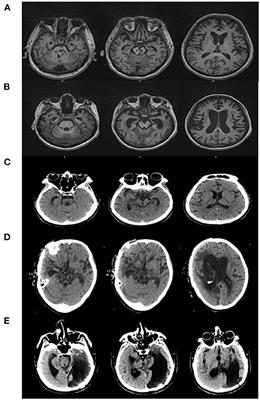 Detecting Residual Awareness in Patients With Prolonged Disorders of Consciousness: An fNIRS Study